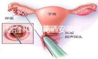 烟台TOTO花洒安装维修电话